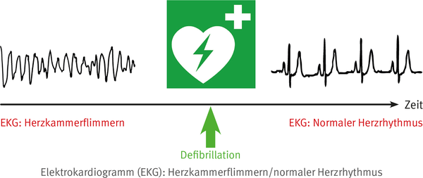 Elektrokardiogramm; Grafik: DGUV